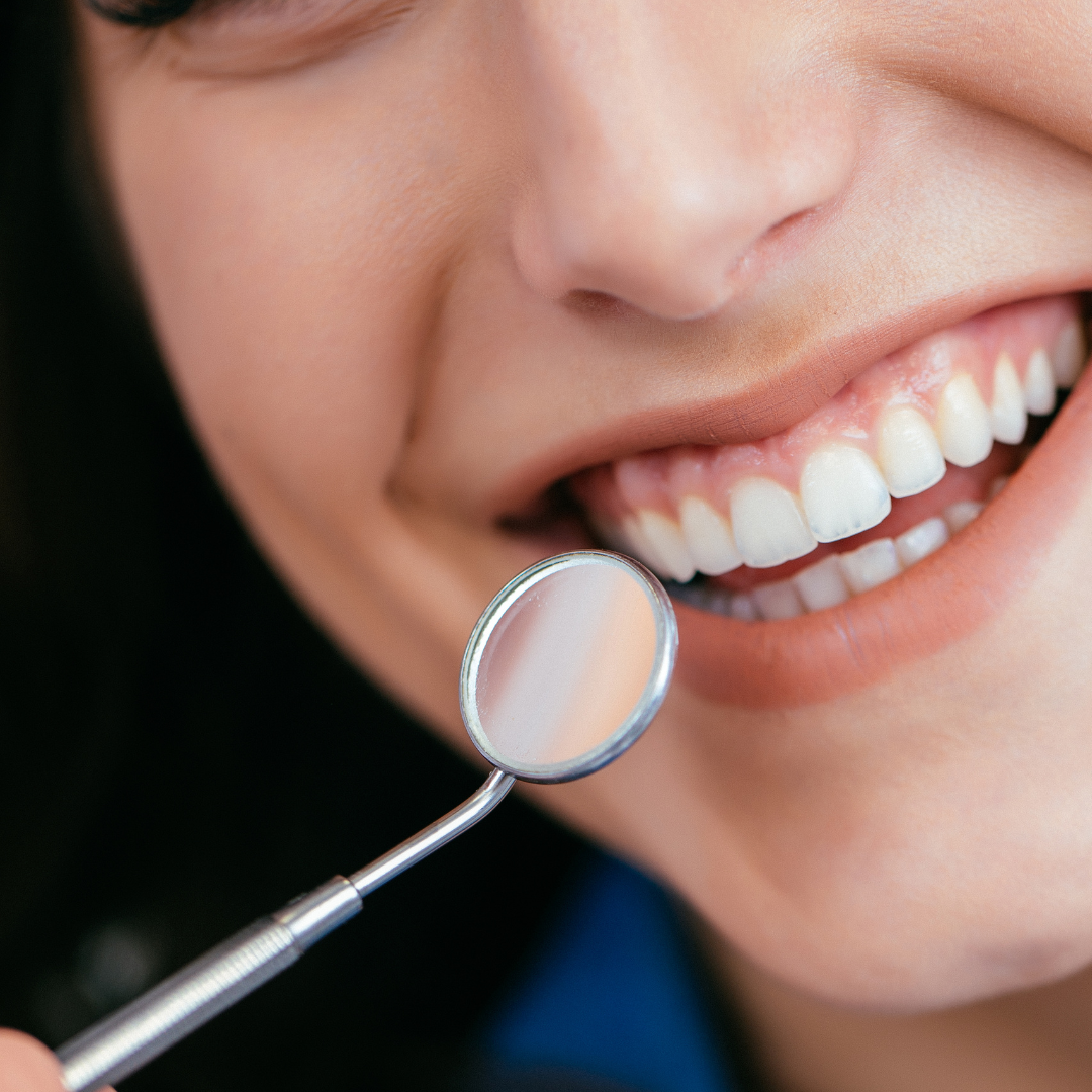 What are the steps of dental implants?